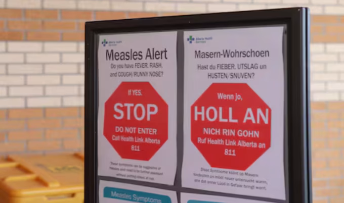 Measles Resurgence Causes Canada to Lose Elimination Status