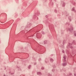 Cladosporium sphaerospermum: The Fungus That Defies Chernobyl's Poison