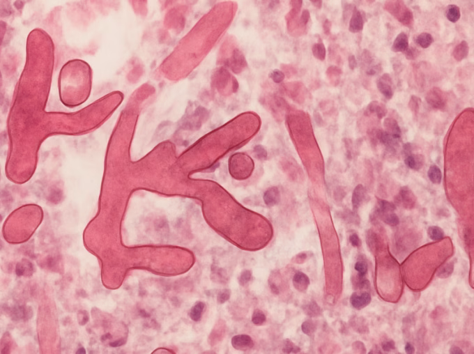 Cladosporium sphaerospermum: The Fungus That Defies Chernobyl's Poison